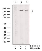 Phospho-NCOA2 (Ser698, Ser699) Antibody in Western Blot (WB)