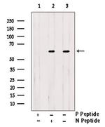 Phospho-GRK1 (Ser21) Antibody in Western Blot (WB)