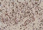 Phospho-PKN2 (Ser815) Antibody in Immunohistochemistry (Paraffin) (IHC (P))