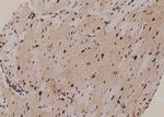 Phospho-PKN2 (Ser815) Antibody in Immunohistochemistry (Paraffin) (IHC (P))