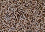 Phospho-PKN2 (Ser815) Antibody in Immunohistochemistry (Paraffin) (IHC (P))