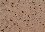 Phospho-PKN2 (Ser815) Antibody in Immunohistochemistry (Paraffin) (IHC (P))