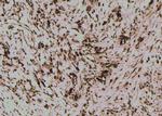 Phospho-MLKL (Ser125) Antibody in Immunohistochemistry (Paraffin) (IHC (P))