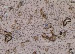 Phospho-MLKL (Ser125) Antibody in Immunohistochemistry (Paraffin) (IHC (P))