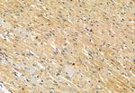 Phospho-MLKL (Ser358) Antibody in Immunohistochemistry (Paraffin) (IHC (P))