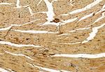 Phospho-MLKL (Ser358) Antibody in Immunohistochemistry (Paraffin) (IHC (P))