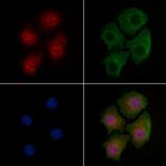 Phospho-SSH3 (Ser9) Antibody in Immunocytochemistry (ICC/IF)