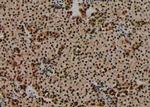 Phospho-Bad (Ser75) Antibody in Immunohistochemistry (Paraffin) (IHC (P))