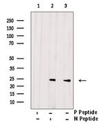 Phospho-Bad (Ser75) Antibody in Western Blot (WB)