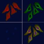 Phospho-LATS2 (Ser380) Antibody in Immunocytochemistry (ICC/IF)