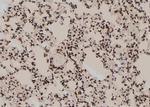 Phospho-GLI3 (Ser664) Antibody in Immunohistochemistry (Paraffin) (IHC (P))