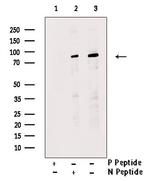 Phospho-Nephrin (Tyr1176) Antibody in Western Blot (WB)