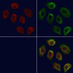 SLC22A8 Antibody in Immunocytochemistry (ICC/IF)