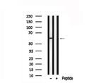 SLC22A8 Antibody in Western Blot (WB)