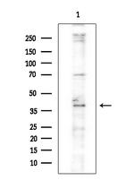 SETD8 Antibody in Western Blot (WB)