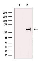 GABRB1 Antibody in Western Blot (WB)