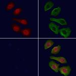 ACK1 Antibody in Immunocytochemistry (ICC/IF)