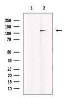 ACK1 Antibody in Western Blot (WB)