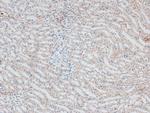 Phospho-IRAK1 (Thr387) Antibody in Immunohistochemistry (Paraffin) (IHC (P))