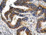 Phospho-NFATC1 (Ser294) Antibody in Immunohistochemistry (Paraffin) (IHC (P))