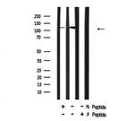 Phospho-NFkB p105 (Ser903) Antibody in Western Blot (WB)