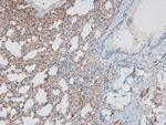 Phospho-PDGFRB (Tyr1009) Antibody in Immunohistochemistry (Paraffin) (IHC (P))