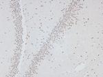 Phospho-PDGFRB (Tyr1009) Antibody in Immunohistochemistry (Paraffin) (IHC (P))