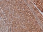 Phospho-PKA alpha (Ser339) Antibody in Immunohistochemistry (Paraffin) (IHC (P))