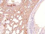 Phospho-RHOA (Ser188) Antibody in Immunohistochemistry (Paraffin) (IHC (P))