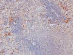 Phospho-RHOA (Ser188) Antibody in Immunohistochemistry (Paraffin) (IHC (P))