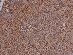 Phospho-VEGF Receptor 2 (Tyr996) Antibody in Immunohistochemistry (Paraffin) (IHC (P))