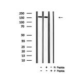 Phospho-VEGF Receptor 2 (Tyr996) Antibody in Western Blot (WB)