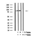 Phospho-TLK1 (Ser741) Antibody in Western Blot (WB)