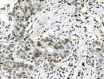 Phospho-TLK1 (Ser741) Antibody in Immunohistochemistry (Paraffin) (IHC (P))