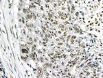 Phospho-TLK1 (Ser741) Antibody in Immunohistochemistry (Paraffin) (IHC (P))