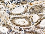 Phospho-TLK1 (Ser741) Antibody in Immunohistochemistry (Paraffin) (IHC (P))