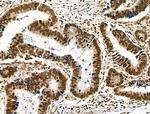 Phospho-TLK1 (Ser741) Antibody in Immunohistochemistry (Paraffin) (IHC (P))