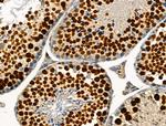 Phospho-TLK1 (Ser741) Antibody in Immunohistochemistry (Paraffin) (IHC (P))