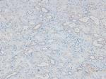 Phospho-FES (Tyr713) Antibody in Immunohistochemistry (Paraffin) (IHC (P))