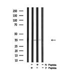 Phospho-Cyclin D1 (Ser90) Antibody in Western Blot (WB)