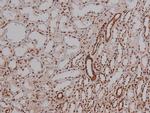 Phospho-4EBP1 (Thr36) Antibody in Immunohistochemistry (Paraffin) (IHC (P))