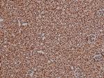 Phospho-4EBP1 (Thr36) Antibody in Immunohistochemistry (Paraffin) (IHC (P))