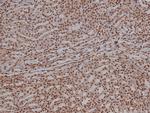 Phospho-4EBP1 (Thr36) Antibody in Immunohistochemistry (Paraffin) (IHC (P))