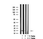 Phospho-4EBP1 (Thr36) Antibody in Western Blot (WB)