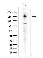 Phospho-DAPK1 (Ser308) Antibody in Western Blot (WB)