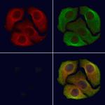 Phospho-DAPK1 (Ser308) Antibody in Immunocytochemistry (ICC/IF)