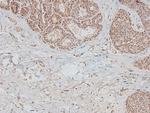 Phospho-DAPK1 (Ser308) Antibody in Immunohistochemistry (Paraffin) (IHC (P))