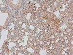 Phospho-DAPK1 (Ser308) Antibody in Immunohistochemistry (Paraffin) (IHC (P))