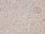 Phospho-DAPK1 (Ser308) Antibody in Immunohistochemistry (Paraffin) (IHC (P))