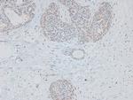 Phospho-ErbB2 (HER-2) (Thr686) Antibody in Immunohistochemistry (Paraffin) (IHC (P))